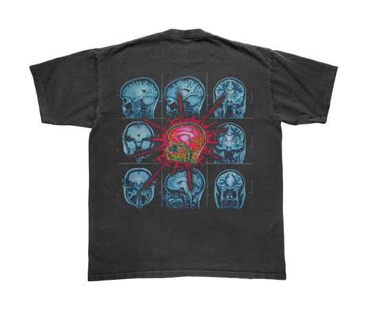 Brainscan Tee